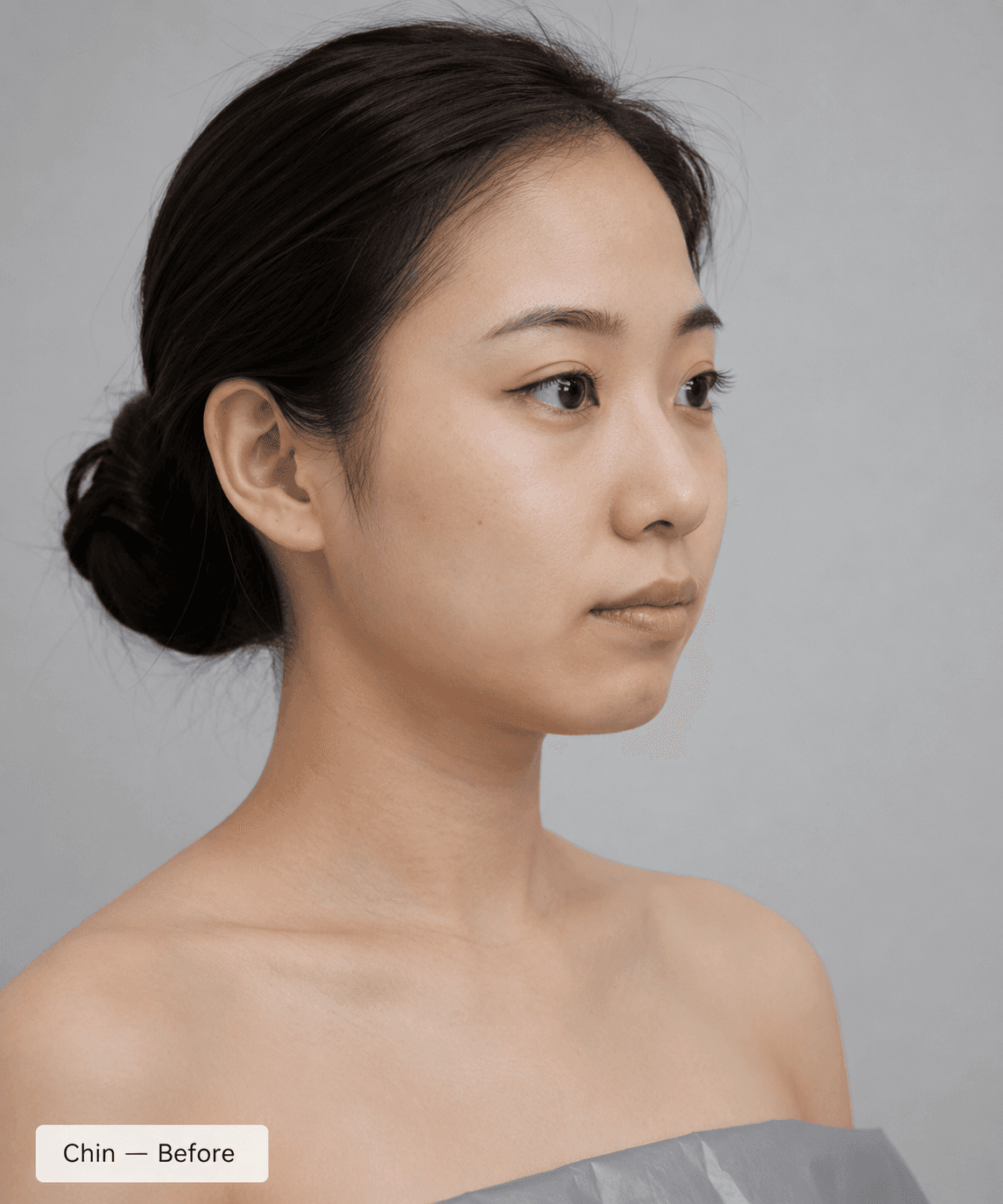 Chin Definition — Before
